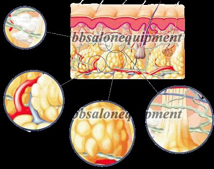   therapy without needles and the Microwave plus Microcurrent, with an